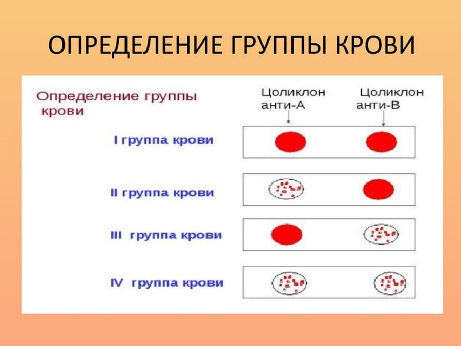 4 группа генетика: найдено 88 изображений