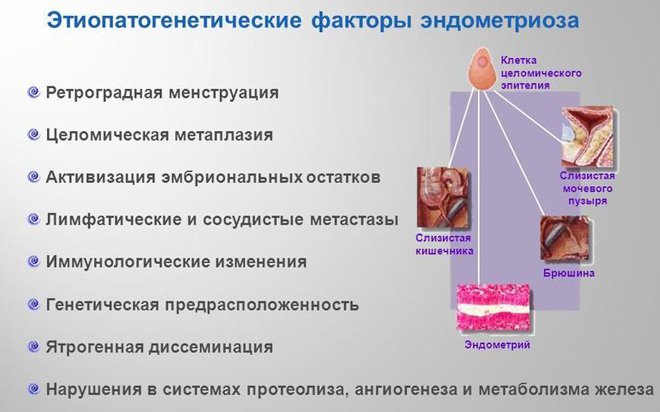 Гипопластического эндометрия